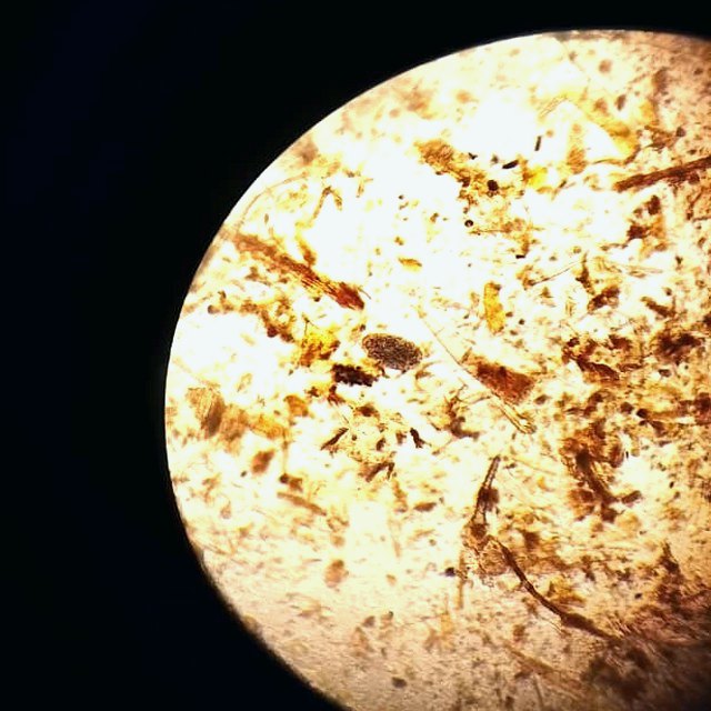 A real faecal-floatation field under the microscope — the bench reality behind the numbers.